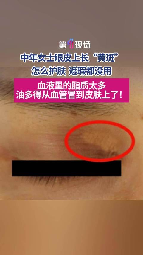 网红3助力韦斯特重拾人生，渔夫与浪子的蜕变之旅：终极指南
